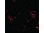 DcR1 Antibody in Immunocytochemistry (ICC/IF)
