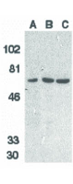 DcR1 Antibody in Western Blot (WB)