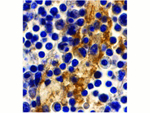 DC-SIGN Antibody in Immunohistochemistry (Paraffin) (IHC (P))
