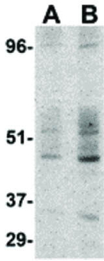 DC-SIGN Antibody in Western Blot (WB)