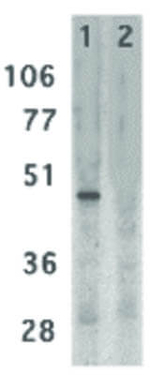 DC-SIGN Antibody in Western Blot (WB)