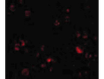 DDX3 Antibody in Immunocytochemistry (ICC/IF)
