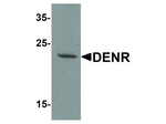 DENR Antibody in Western Blot (WB)