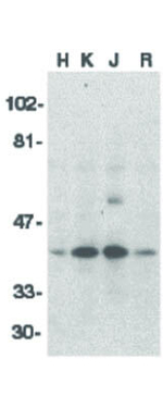 DFF40 Antibody in Western Blot (WB)