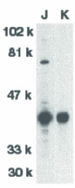 DFF40 Antibody in Western Blot (WB)