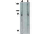 DISC1 Polyclonal Antibody
