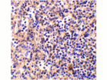 DNase II Polyclonal Antibody