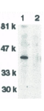 DNase II Antibody in Western Blot (WB)