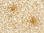 DOCK8 Polyclonal Antibody