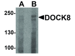 DOCK8 Antibody in Western Blot (WB)