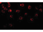 DOK1 Antibody in Immunocytochemistry (ICC/IF)