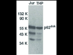 DOK1 Antibody in Western Blot (WB)