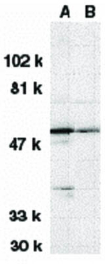 DRAK1 Antibody in Western Blot (WB)