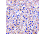 DRAM Antibody in Immunohistochemistry (Paraffin) (IHC (P))