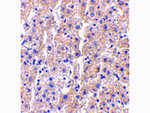 DRAM Antibody in Immunohistochemistry (Paraffin) (IHC (P))