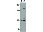 DRAM Antibody in Western Blot (WB)