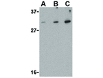 DRAM Antibody in Western Blot (WB)