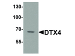 DTX4 Polyclonal Antibody