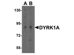 DYRK1A Antibody in Western Blot (WB)