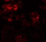 DYRK2 Antibody in Immunocytochemistry (ICC/IF)
