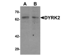 DYRK2 Antibody in Western Blot (WB)