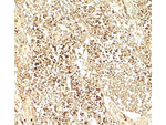 E2F3 Antibody in Immunohistochemistry (Paraffin) (IHC (P))