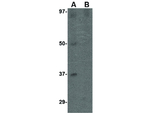 EBI3 Antibody in Western Blot (WB)