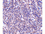 EBI3 Antibody in Immunohistochemistry (Paraffin) (IHC (P))