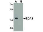 EDA1 Polyclonal Antibody