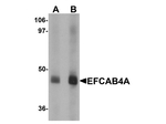 EFCAB4A Polyclonal Antibody
