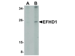EFHD1 Antibody in Western Blot (WB)