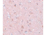 EFHD2 Antibody in Immunohistochemistry (Paraffin) (IHC (P))