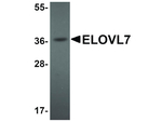 ELOVL7 Antibody in Western Blot (WB)