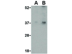 Emerin Antibody in Western Blot (WB)