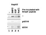 Phospho-SMAD1 (Ser206) Polyclonal Antibody