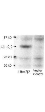 UBE2J2 Polyclonal Antibody