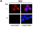 CASZ1 Polyclonal Antibody