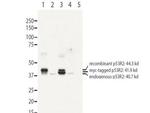 RRM2B p53R2 Polyclonal Antibody