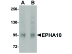 EphA10 Polyclonal Antibody