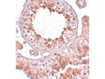ESX1 Antibody in Immunohistochemistry (Paraffin) (IHC (P))
