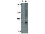 EVER1 Antibody in Western Blot (WB)