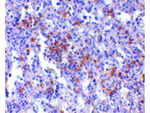 EVER1 Antibody in Immunohistochemistry (Paraffin) (IHC (P))