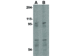 EVER1 Antibody in Western Blot (WB)