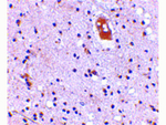 EVER2 Antibody in Immunohistochemistry (Paraffin) (IHC (P))