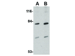 EVER2 Antibody in Western Blot (WB)