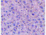 F1A alpha Antibody in Immunohistochemistry (Paraffin) (IHC (P))