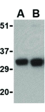 FAIM2 Antibody in Western Blot (WB)
