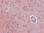 FAM120A Antibody in Immunohistochemistry (Paraffin) (IHC (P))