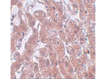 FAM59A Antibody in Immunohistochemistry (Paraffin) (IHC (P))