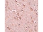FAM59B Antibody in Immunohistochemistry (Paraffin) (IHC (P))